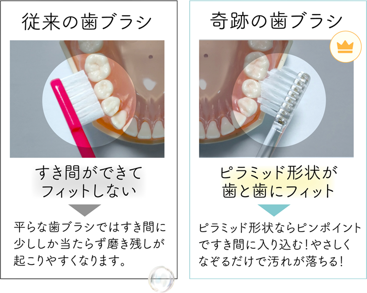 【従来の歯ブラシ】隙間ができてフィットしない　【奇跡の歯ブラシ】ピラミッド形状が歯と歯にフィット